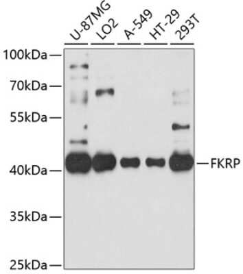 Western Blot: FKRP Antibody [NBP3-04945] - Analysis of extracts of various cell lines, using FKRP antibody at 1:1000 dilution. Secondary antibody: HRP Goat Anti-Rabbit IgG (H+L) at 1:10000 dilution. Lysates/proteins: 25ug per lane. Blocking buffer: 3% nonfat dry milk in TBST. Detection: ECL Basic Kit