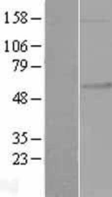 Western Blot: FKRP Overexpression Lysate (Adult Normal) [NBL1-10743] Left-Empty vector transfected control cell lysate (HEK293 cell lysate); Right -Over-expression Lysate for FKRP.