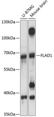 Western Blot: FLAD1 Antibody [NBP3-05008] - Analysis of extracts of various cell lines, using FLAD1 antibody at 1:3000 dilution. Secondary antibody: HRP Goat Anti-Rabbit IgG (H+L) at 1:10000 dilution. Lysates/proteins: 25ug per lane. Blocking buffer: 3% nonfat dry milk in TBST. Detection: ECL Basic Kit