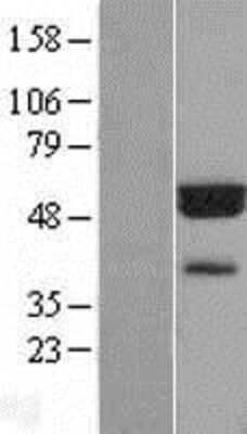 Western Blot: FLAD1 Overexpression Lysate (Adult Normal) [NBL1-10746] Left-Empty vector transfected control cell lysate (HEK293 cell lysate); Right -Over-expression Lysate for FLAD1.