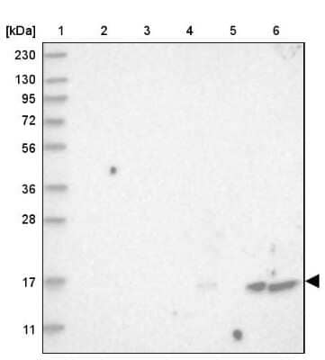 <b>Orthogonal Strategies Validation. </b>Western Blot: FLAP Antibody [NBP1-84666] - Lane 1: Marker  [kDa] 230, 130, 95, 72, 56, 36, 28, 17, 11.  Lane 2: Human cell line RT-4.  Lane 3: Human cell line U-251MG sp.  Lane 4: Human plasma (IgG/HSA depleted).  Lane 5: Human liver tissue.  Lane 6: Human tonsil tissue