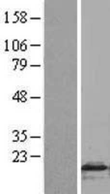 Western Blot: FLAP Overexpression Lysate (Adult Normal) [NBL1-07484] Left-Empty vector transfected control cell lysate (HEK293 cell lysate); Right -Over-expression Lysate for FLAP.