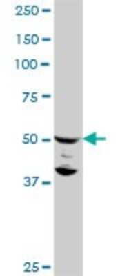 Western Blot: FLI1 Antibody (2D6) [H00002313-M06] - Analysis of FLI1 expression in C32 (Cat # L002V1).