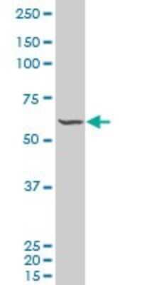 Western Blot: FLI1 Antibody (2D6) [H00002313-M06] - Analysis of FLI1 expression in RIN-m5F.