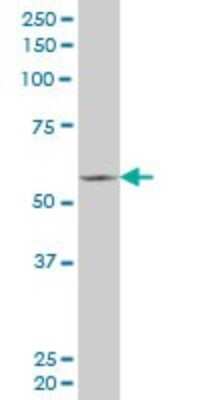 Western Blot: FLI1 Antibody (2G8) [H00002313-M02] - FLI1 monoclonal antibody (M02), clone 2G8. Analysis of FLI1 expression in RIN-m5F.