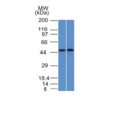 Western Blot: FLI1 Antibody (FLI1/1312) [NBP2-53335] - Western Blot of THP1 and Raji Cell Lysate using FLI1 Monoclonal Antibody (FLI1/1312)