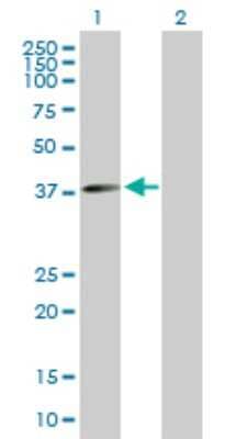 Western Blot: FLJ10357 Antibody [H00055701-B01P] - Analysis of FLJ10357 expression in transfected 293T cell line by FLJ10357 polyclonal antibody.  Lane 1: FLJ10357 transfected lysate(35.86 KDa). Lane 2: Non-transfected lysate.