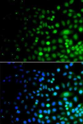 Immunocytochemistry/Immunofluorescence: FLJ10808 Antibody [NBP3-03402] - Analysis of A549 cells using FLJ10808 antibody . Blue: DAPI for nuclear staining.