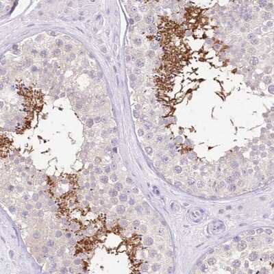 Immunohistochemistry-Paraffin: FLJ10808 Antibody [NBP1-87911] - Staining of human testis shows distinct positivity in spermatids.