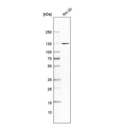 Western Blot: FLJ10808 Antibody [NBP1-87911] - Analysis in human cell line RH-30.