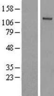 Western Blot: FLJ10808 Overexpression Lysate (Adult Normal) [NBL1-17501] Left-Empty vector transfected control cell lysate (HEK293 cell lysate); Right -Over-expression Lysate for FLJ10808.