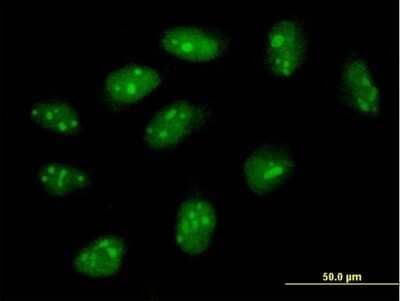 Immunocytochemistry/Immunofluorescence: FLJ11184 Antibody [H00055319-B01P] - Analysis of purified antibody to FLJ11184 on HeLa cell. (antibody concentration 10 ug/ml)