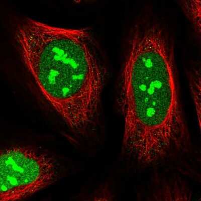 Immunocytochemistry/Immunofluorescence: FLJ11184 Antibody [NBP1-87907] - Immunofluorescent staining of human cell line U-2 OS shows localization to nucleus & nucleoli.
