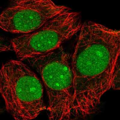 Immunocytochemistry/Immunofluorescence: FLJ11184 Antibody [NBP2-55828] - Staining of human cell line MCF7 shows localization to nucleus & nucleoli.