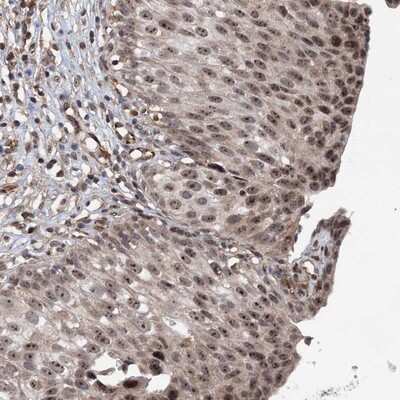 Immunohistochemistry-Paraffin: FLJ11184 Antibody [NBP1-87907] - Staining of human urinary bladder shows moderate nucleolar positivity in urothelial cells.