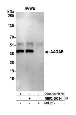 Immunoprecipitation: FLJ11506 Antibody [NBP2-59084] - Detection of human AAGAB by western blot of immunoprecipitates. Samples: Whole cell lysate (0.5 or 1.0 mg per IP reaction; 20% of IP loaded) from Jurkat cells prepared using NETN lysis buffer. Antibodies: Affinity purified rabbit anti-AAGAB antibody NBP2-59084 used for IP at 50 ul per reaction. AAGAB was also immunoprecipitated by another rabbit anti-AAGAB antibody. For blotting immunoprecipitated AAGAB, NBP2-59084 was used at 1:400. Detection: Chemiluminescence with an exposure time of 30 seconds.