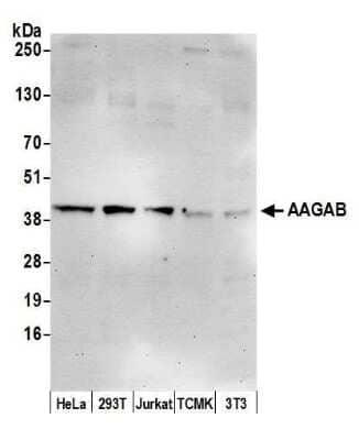 Western Blot: FLJ11506 Antibody [NBP2-59084] - Detection of human and mouse AAGAB by western blot. Samples: Whole cell lysate (15 ug) from HeLa, 293T, Jurkat, mouse TCMK-1, and mouse NIH3T3 cells prepared using NETN lysis buffer. Antibody: Affinity purified rabbit anti-AAGAB antibody NBP2-59084 used for WB at 1:1000. Detection: Chemiluminescence with an exposure time of 30 seconds.