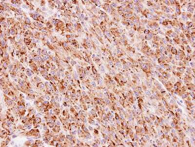 Immunohistochemistry-Paraffin: FLJ13946 Antibody [NBP1-32574] - Paraffin-embedded U87 xenograft, using antibody at 1:100 dilution.