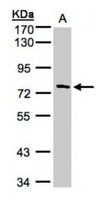 Western Blot: FLJ13946 Antibody [NBP1-32574] - (30 ug whole cell lysate) A:431 7. 5% SDS PAGE, antibody diluted at 1:1000.