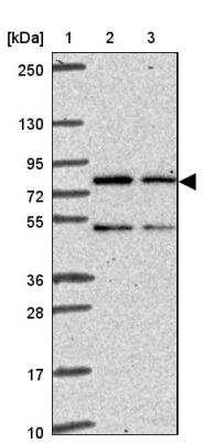 Western Blot: FLJ13946 Antibody [NBP2-46792] - Lane 1: Marker  [kDa] 250, 130,95,72,55,36,28,17,10.  Lane 2: Human cell line RT-4.  Lane 3: Human cell line U-251 MG.