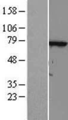 Western Blot: FLJ13946 Overexpression Lysate (Adult Normal) [NBL1-17405] Left-Empty vector transfected control cell lysate (HEK293 cell lysate); Right -Over-expression Lysate for FLJ13946.