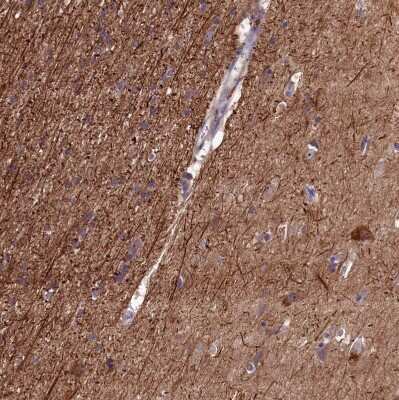 Immunohistochemistry-Paraffin FLJ14154 Antibody