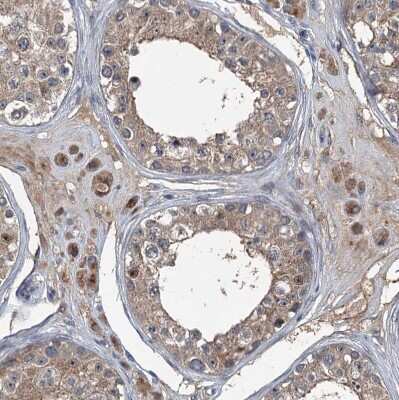 Immunohistochemistry-Paraffin FLJ14154 Antibody