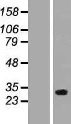 Western Blot: FLJ14154 Overexpression Lysate (Adult Normal) [NBP2-10655] Left-Empty vector transfected control cell lysate (HEK293 cell lysate); Right -Over-expression Lysate for FLJ14154.