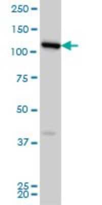 Western Blot: FLJ20097 Antibody (2D11) [H00055610-M01] - FLJ20097 monoclonal antibody (M01), clone 2D11 Analysis of FLJ20097 expression in HeLa.