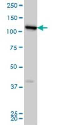 Western Blot: FLJ20097 Antibody (2D11) [H00055610-M01] - FLJ20097 monoclonal antibody (M01), clone 2D11 Analysis of FLJ20097 expression in HeLa.