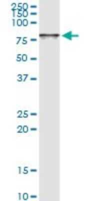 Western Blot: FLJ21908 Antibody [H00079657-D01P] - Analysis of RPAP3 expression in human pancreas.