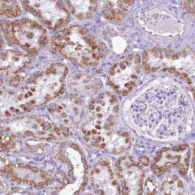 Immunohistochemistry FLJ21963 Antibody - BSA Free