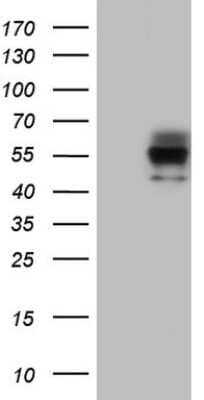 Western Blot: FLJ23356 Antibody (2B10) [NBP2-45805] - Analysis of HEK293T cells were transfected with the pCMV6-ENTRY control (Left lane) or pCMV6-ENTRY FLJ23356.