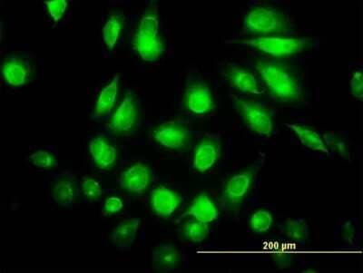 Immunocytochemistry/Immunofluorescence: FLJ23356 Antibody (6F10) [H00084197-M03] - Analysis of monoclonal antibody to FLJ23356 on HeLa cell. Antibody concentration 10 ug/ml