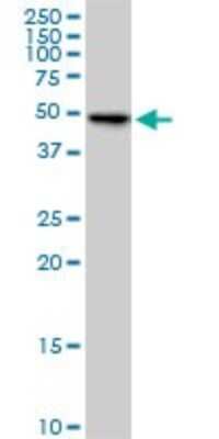 Western Blot: FLJ23356 Antibody (6F10) [H00084197-M03] - Analysis of FLJ23356 expression in HeLa(Cat # L013V1).