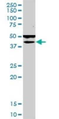 Western Blot: FLJ23356 Antibody (6F10) [H00084197-M03] - Analysis of FLJ23356 expression in HepG2 (Cat # L019V1).