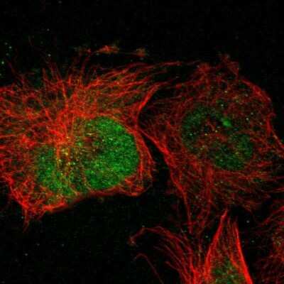 Immunocytochemistry/Immunofluorescence: FLJ23356 Antibody [NBP2-13302] - Immunofluorescent staining of human cell line U-251 MG shows localization to nucleus & cytosol.
