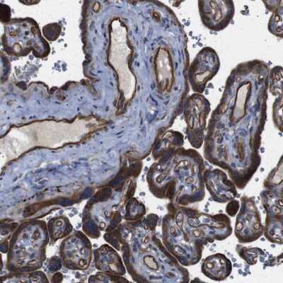 Immunohistochemistry-Paraffin: FLJ23356 Antibody [NBP2-13302] - Staining of human placenta shows strong cytoplasmic positivity in trophoblastic cells and endothelial cells.