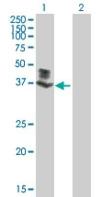 Western Blot: FLJ23356 Antibody [H00084197-B01P] - Analysis of SGK196 expression in transfected 293T cell line by SGK196 polyclonal antibody.  Lane 1: FLJ23356 transfected lysate(38.5 KDa). Lane 2: Non-transfected lysate.
