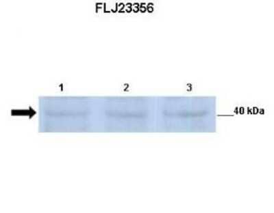 Western Blot: FLJ23356 Antibody [NBP1-59695] - Lanes: Lane 1: 30 ug mouse renal epithelial lysate Lane 2: 30 ug mouse renal epithelial lysate Lane 3: 30 ug mouse renal epithelial lysate Primary Antibody Dilution: 1:500 Secondary Antibody: Anti-rabbit-HRP Secondary Antibody Dilution: 1:2500 Gene Name: