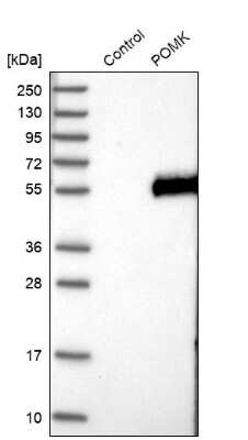 Western Blot: FLJ23356 Antibody [NBP2-13302] - Analysis in control (vector only transfected HEK293T lysate) and POMK over-expression lysate (Co-expressed with a C-terminal myc-DDK tag (3.1 kDa) in mammalian HEK293T cells).