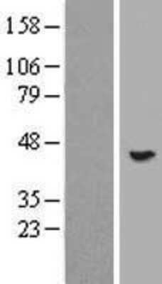 Western Blot: FLJ23356 Overexpression Lysate (Adult Normal) [NBP2-06056] Left-Empty vector transfected control cell lysate (HEK293 cell lysate); Right -Over-expression Lysate for FLJ23356.