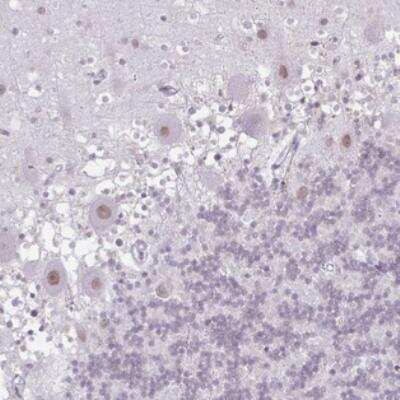 Immunohistochemistry FLJ23584 Antibody - BSA Free