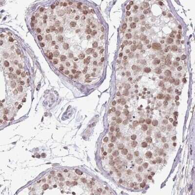 Immunohistochemistry-Paraffin FLJ23584 Antibody - BSA Free