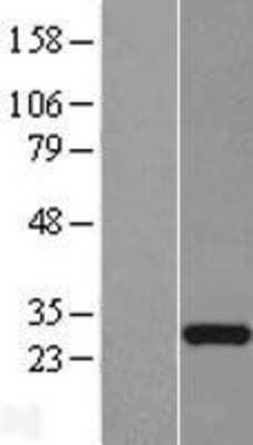 Western Blot: FLJ23584 Overexpression Lysate (Adult Normal) [NBL1-10760] Left-Empty vector transfected control cell lysate (HEK293 cell lysate); Right -Over-expression Lysate for FLJ23584.