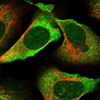 Immunocytochemistry/Immunofluorescence: FLJ25006 Antibody [NBP2-47455] - Staining of human cell line U-2 OS shows localization to plasma membrane.