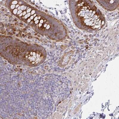 Immunohistochemistry: FLJ25006 Antibody [NBP2-47455] - Staining of human rectum shows strong cytoplasmic positivity in glandular cells.