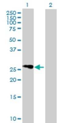 Western Blot: FLJ25006 Antibody [H00124923-B01P] - Analysis of FLJ25006 expression in transfected 293T cell line by FLJ25006 polyclonal antibody.  Lane 1: FLJ25006 transfected lysate(30.14 KDa). Lane 2: Non-transfected lysate.