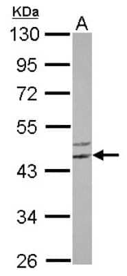 Western Blot FLJ25006 Antibody