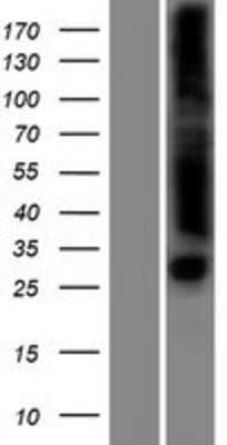 Western Blot: FLJ35220 Overexpression Lysate (Adult Normal) [NBP2-05124] Left-Empty vector transfected control cell lysate (HEK293 cell lysate); Right -Over-expression Lysate for FLJ35220.